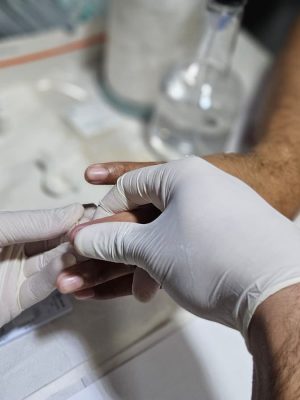 O Amazonas encerra 2025 com dados que apontam uma redução de 20,7% na mortalidade por Aids entre 2013 e 2023, conforme o último boletim HIV do Ministério da Saúde. A queda acompanha a ampliação de políticas públicas de prevenção, diagnóstico e tratamento das Infecções Sexualmente Transmissíveis (ISTs) no estado.